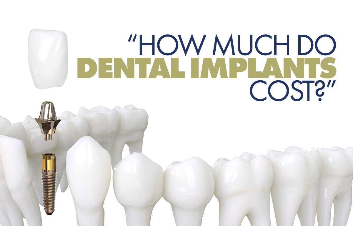 Factors that determine the cost of dental implant treatment