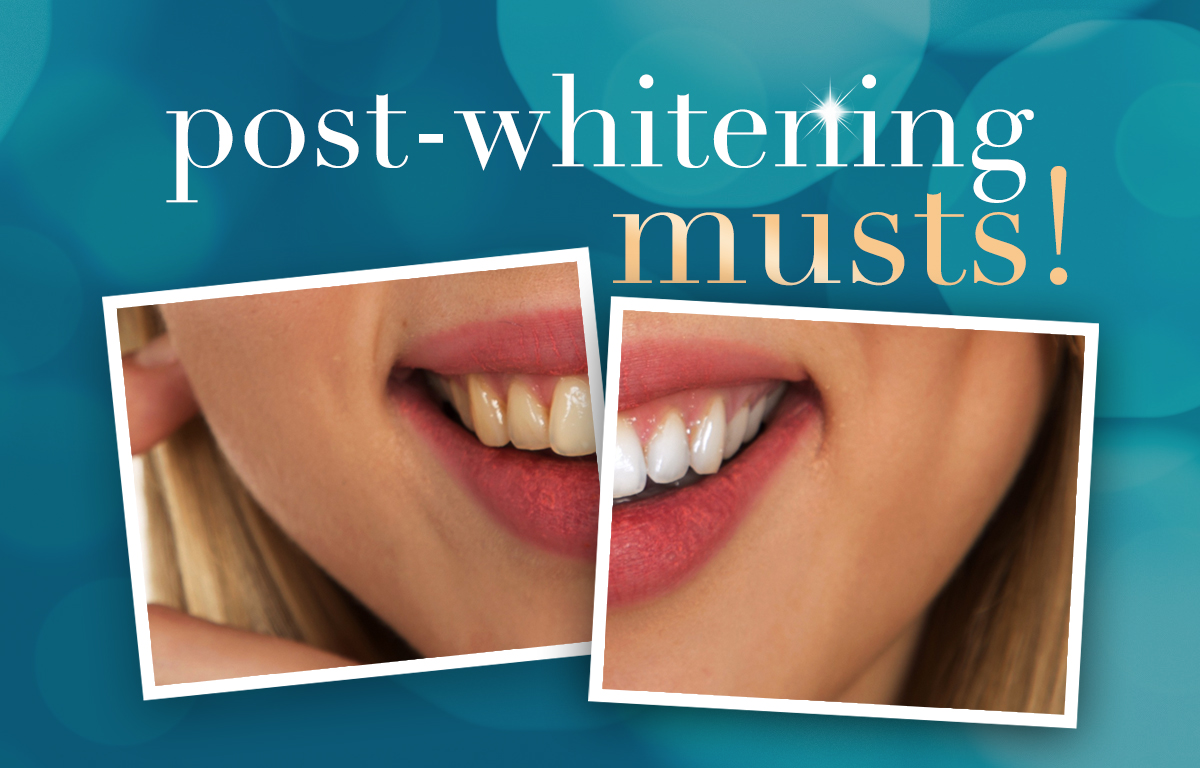 Before and after picture of tooth whitening
