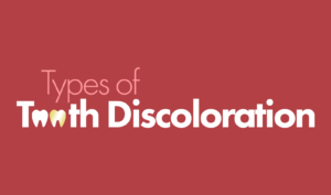Test on red background: Types of tooth discoloration